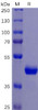 Human TNFRSF10B Recombinant Protein mFc Tag HDPT0079