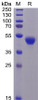 Human CD5 Recombinant Protein His Tag HDPT0083