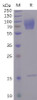 Human CD30 Recombinant Protein His Tag HDPT0093