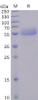 Human ICOS Recombinant Protein hFc Tag HDPT0094