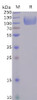 Human CD155 Recombinant Protein hFc Tag HDPT0095