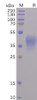 SARS-CoV-2 Spike-Membrane Recombinant Fusion Recombinant Protein His Tag HDPT0103