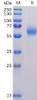 SARS-CoV-2 2019-nCoV Nucleocapsid, His Tag HDPT0108