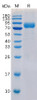 Human CD19 Recombinant Protein hFc-His Tag HDPT0111