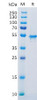 Human CA9 Recombinant Protein His Tag HDPT0127