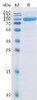 Human FAP Recombinant Protein His Tag HDPT0131