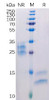 Human VEGFA Recombinant Protein His Tag HDPT0134
