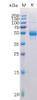 Human TNFSF11 Recombinant Protein hFc Tag HDPT0138