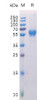 Human ROR1 Recombinant Protein His Tag HDPT0143