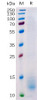 Human BCMA Recombinant Protein His Tag HDPT0144