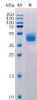 Human MICB Recombinant Protein His Tag HDPT0148