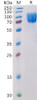Human CD117 Recombinant Protein His Tag HDPT0156