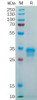 Human FOLR1 Recombinant Protein His Tag HDPT0169