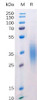 Mouse BTLA Recombinant Protein His Tag HDPT0176