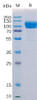 Human AXL Recombinant Protein mFc Tag HDPT0180