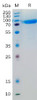 Human IL6R Recombinant Protein hFc Tag HDPT0182
