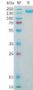 Human CD56 Recombinant Protein hFc Tag HDPT0187