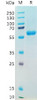 SARS-CoV-2 2019-nCoV S protein RBDN501Y, hFc Tag HDPT0190