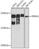 Anti-PBRM1 Antibody CAB0334