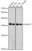 Anti-EXOSC7 Antibody CAB0341