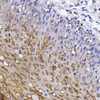Anti-SerpinB3 Antibody CAB0455