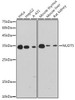 Anti-NUDT5 Antibody CAB0609