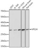 Anti-VPS24 Antibody CAB0941