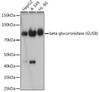 Anti-beta glucuronidase GUSB Antibody CAB19248