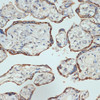 Anti-Placental lactogen CSH1 Antibody CAB19258