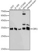 Anti-CBR1 Antibody CAB19263
