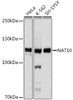Anti-NAT10 Antibody CAB19286