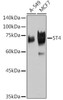 Anti-5T4 Antibody CAB19541