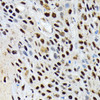 Anti-ENT2/SLC29A2 Antibody CAB19691