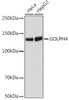 Anti-GOLPH4 Antibody CAB19790