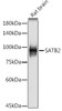 Anti-SATB2 Antibody CAB19837