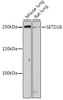Anti-SETD1B Antibody CAB20155