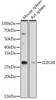 Anti-CLEC4E Antibody CAB20156