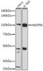 Anti-HASPIN Antibody CAB20180