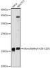 Anti-MonoMethyl-H2B-E105 Antibody CAB20230