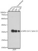 Anti-SARS-CoV-2 Spike S2 Antibody CAB20284