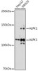 Anti-ALPK1 Antibody CAB20310