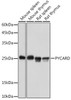 Anti-PYCARD Antibody CAB20484