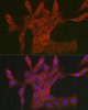 Anti-DAB2IP Antibody CAB20493