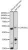 Anti-CYP39A1 Antibody CAB20530