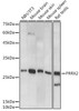 Anti-PRRX2 Antibody CAB20558