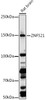 Anti-ZNF521 Antibody CAB20646
