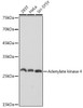 Anti-Adenylate kinase 4 Antibody CAB2383