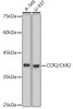Anti-CCR2/CKR2 Antibody CAB2385