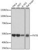 Anti-FNTB Antibody CAB2611