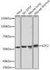 Anti-E2F2 Antibody CAB3297